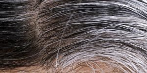 canas
